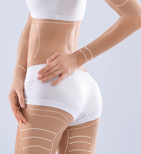 Young woman with marks for liposuction operation and space for text on light background. Cosmetic surgery