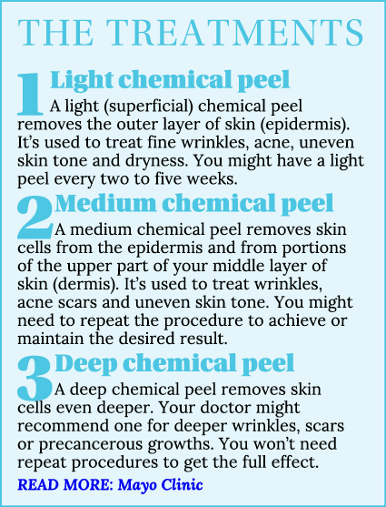 THe treatments 1 Light chemical peel A light (superficial) chemical peel removes the outer layer of skin (epidermis)....