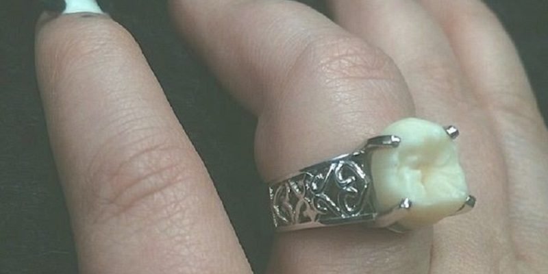 This woman’s engagement ring is made from her partner’s tooth