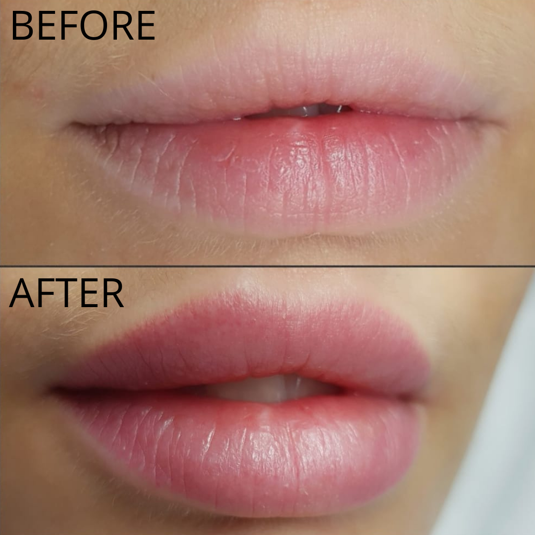 permanent makeup treatment